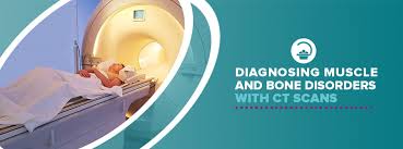 A ct scan of the chest can help find problems such as infection, lung cancer, blocked blood flow in the lung (pulmonary embolism), and other lung problems. Diagnosing Muscle And Bone Disorders With Ct Scans