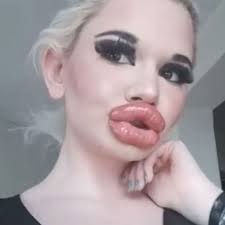 real life barbie shows off giant lips