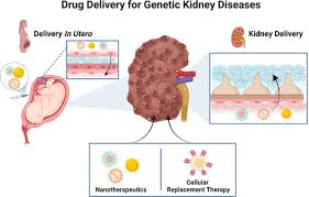 Spotlight On Genetic Kidney Diseases A