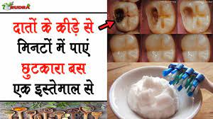 how to get rid of tooth cavity at home