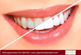 It is a unique home remedy for teeth whitening and for killing the harmful bacteria in your mouth. Pin On Best Dentist In Quakertown