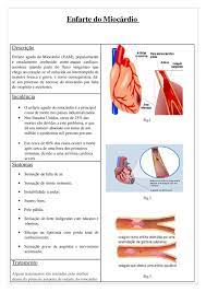 Nstemi = enfarte do miocárdio sem elevação do segmento st. Enfarte Do Miocardio By Diana Silva Issuu
