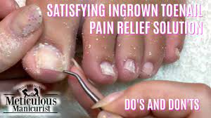 relieve ingrown toenail pain do s