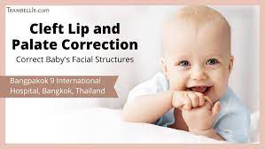 cleft lip and palate correction