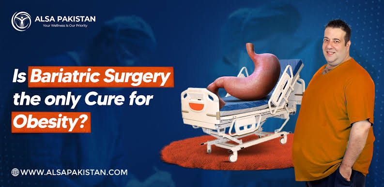 Is bariatric surgery the only cure for obesity?