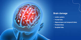 disease affect on the brain