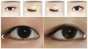 double eyelid surgery in korea