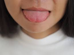 tongue cancer images browse 1 001