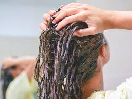 treatment and home remes for dry scalp