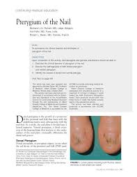 pterygium of the nail cutis