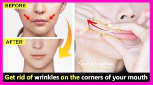 fold lines on the corners of your mouth