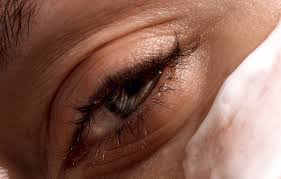 treating under eye wrinkles expert