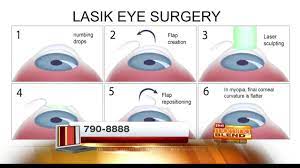 am i a good candidate for lasik you