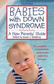 Down syndrome can affect how a person looks and thinks, and it's sometimes linked with other health problems, as well. Babies With Down Syndrome A New Parents Guide Susan J Skallerup 9781890627553 Amazon Com Books