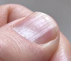 What Your Fingernails Are Trying To Tell You About Your