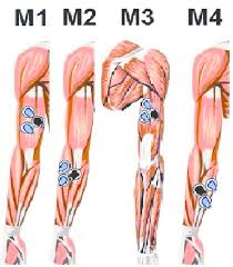 Maybe you would like to learn more about one of these? Position Of The Electrodes On The Right Arm Muscles M1 Biceps Download Scientific Diagram