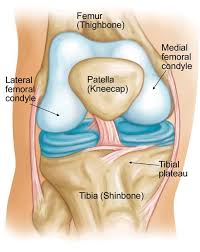 Medial epicondyle — can refer to: Osteonecrosis Of The Knee Orthoinfo Aaos