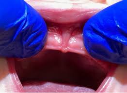 boise integrative dentistry uses state