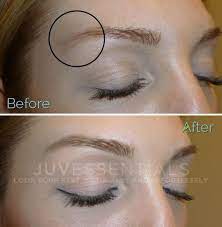 eyebrow tattoo correction juvessentials