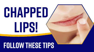 chapped lips suffering from chapped