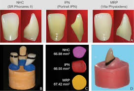 Failure Strengths Of Denture Teeth Fabricated On Injection