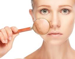 treatment for skin pigmentation