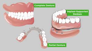 Restorative Care vs Dentures Impact of Dentures on Health