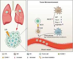 lung cancer using radiotherapy