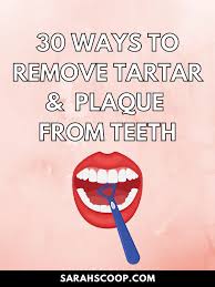 30 home remes to remove tartar and