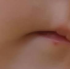 red dot on lip any idea what it is pic