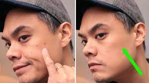 men here s how to cover up a pimple