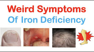 weird symptoms of iron deficiency