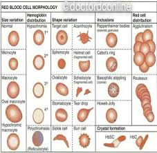 Red Blood Cell Morphology Medical Laboratory Medical Lab