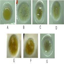 spot urine chemical test