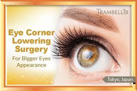 eye corner lowering surgery for bigger