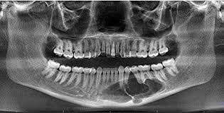 cone beam ct imaging center