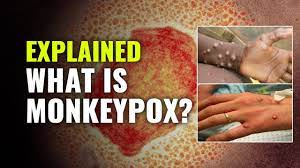 Symptoms Of Monkeypox Virus Infection ...