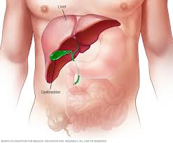 When cancer starts in the liver, it is called liver cancer. Liver Cancer Symptoms And Causes Mayo Clinic