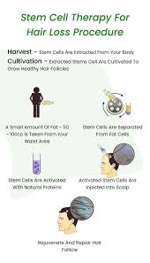 stem cell hair treatment revitalizing