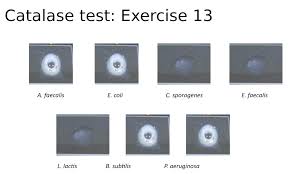 solved oxidase test exercise 14 a