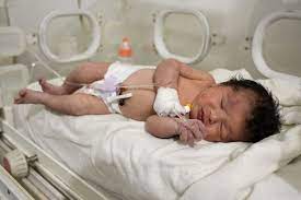 newborn with umbilical cord intact is