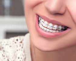 Orthodontics Smile Design Dental Group