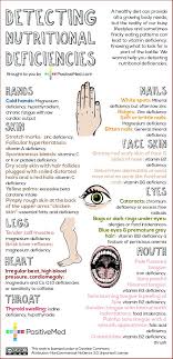 Nutritional Deficiencies Red Aspen Wellness Acupuncture