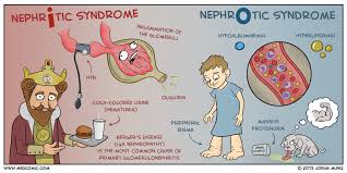 Nephritic Vs Nephrotic Syndrome Medcomic