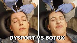 We did not find results for: Dysport Vs Botox Crow S Feet Forehead 11s Before After Does It Work Pain Youtube