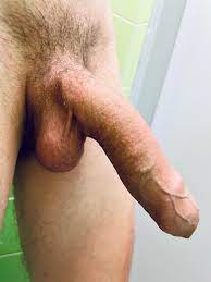File:Human testicles + penis photo.jpg - Wikimedia Commons