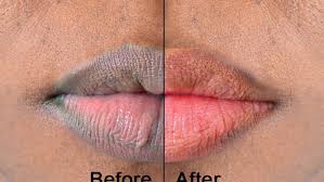 5 natural ways to make your lips soft
