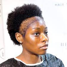 do relaxers cause hair loss reasons