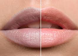 dark lips treatment saavya