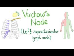 left supraclavicular lymph node